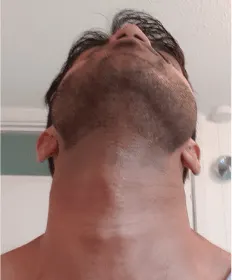 shave neck stubble