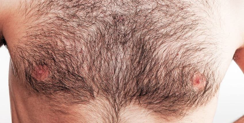 Trimming Chest Hair With Beard Trimmers: Essential Guide