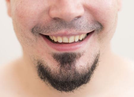 Bald man with achor goatee