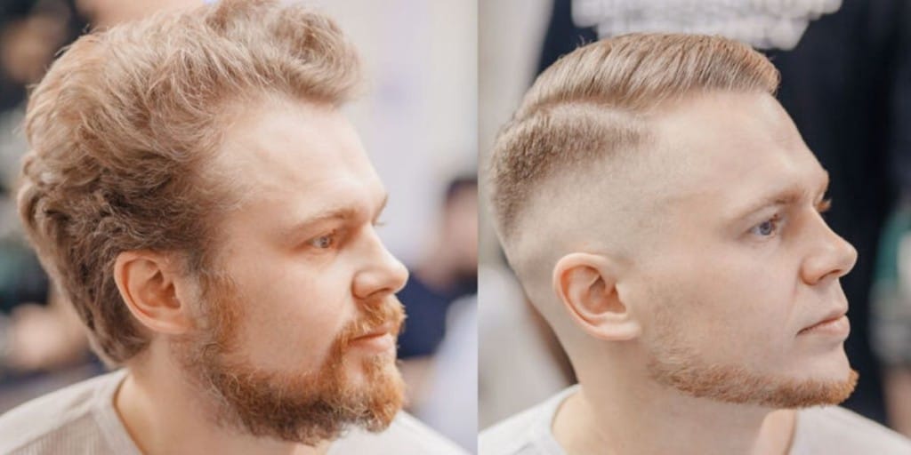 Buzz Cuts For Thinning Hair: Before And After, Styles, More • Ready Sleek Buzz Cuts For Thinning Hair: Before And After, Styles, More • Ready Sleek