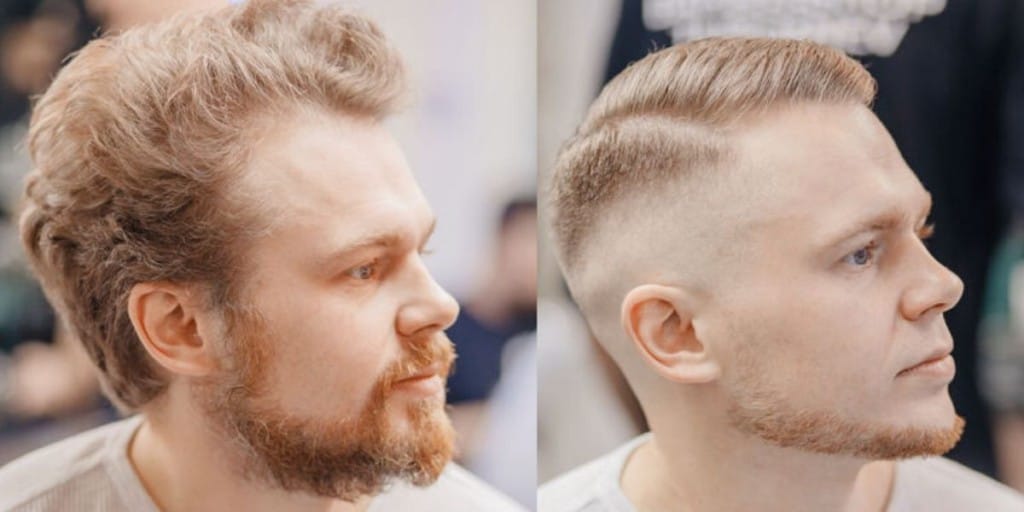 Buzz Cuts For Thinning Hair: Before And After, Styles, More • Ready Sleek