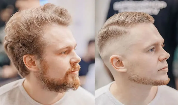 Before and after, receding hairline with a buzz cut