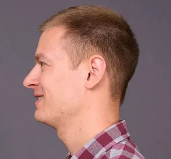 Side profile of number 4 buzz cut