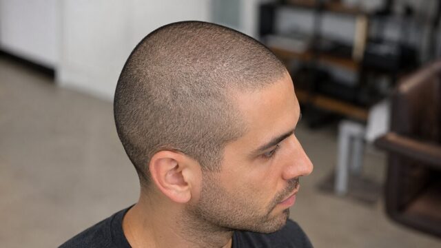 Uniform 1mm buzz cut shown from a three-quarter side view