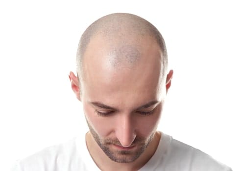 Example of a 1mm haircut