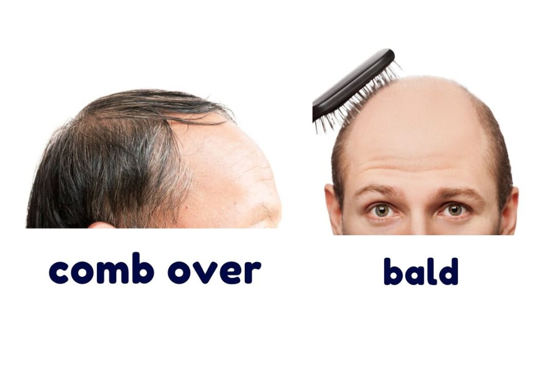 The Comb Over Vs Other Balding Styles [Photo Comparisons] • Ready Sleek